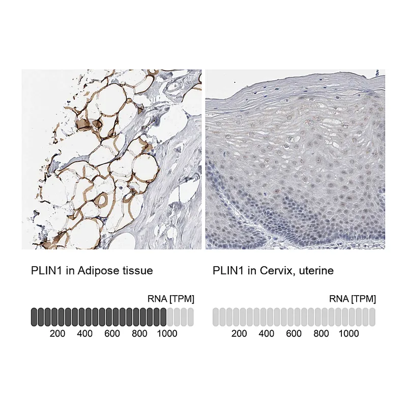 Atlas Antibodies Anti-PLIN1 Antibody