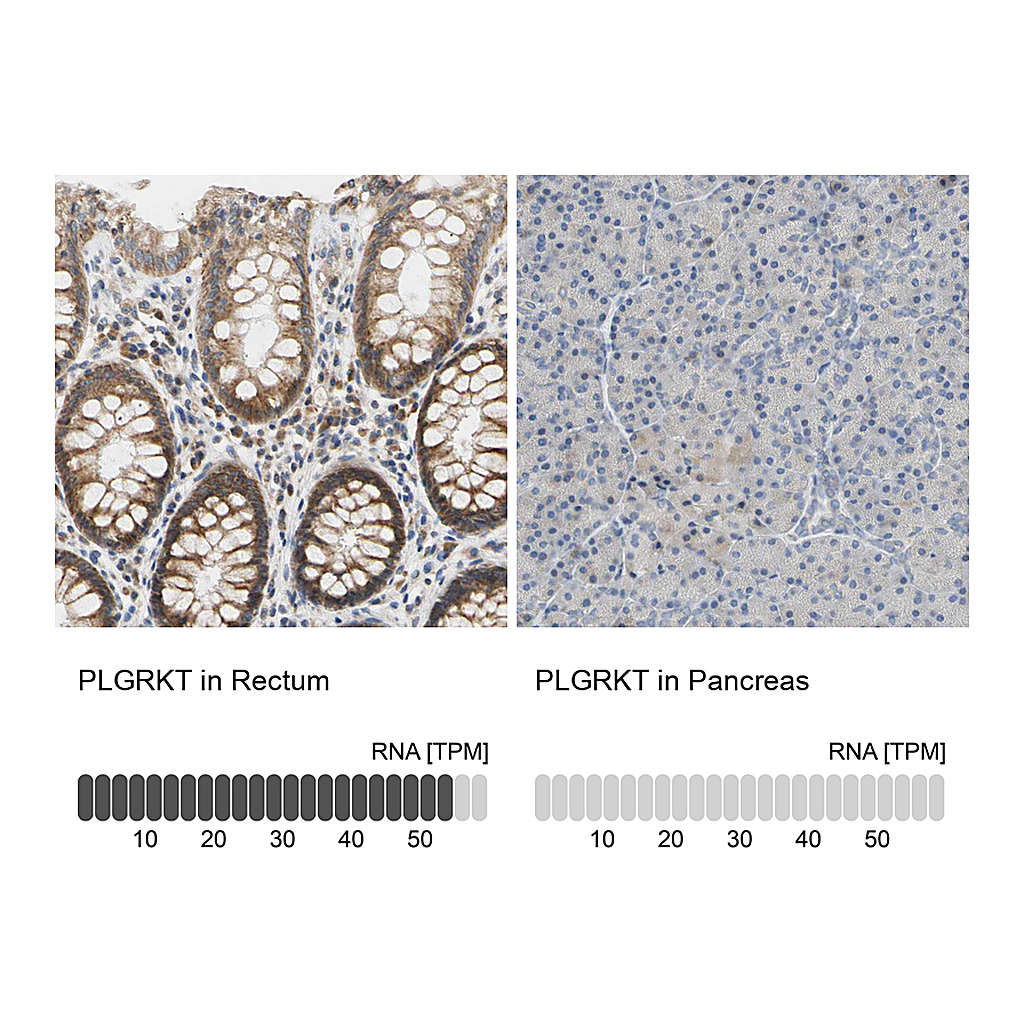 Atlas Antibodies Anti-PLGRKT Antibody