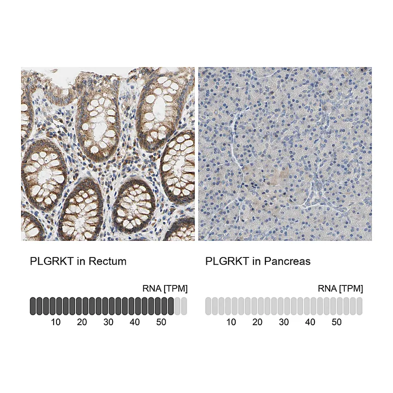 Atlas Antibodies Anti-PLGRKT Antibody