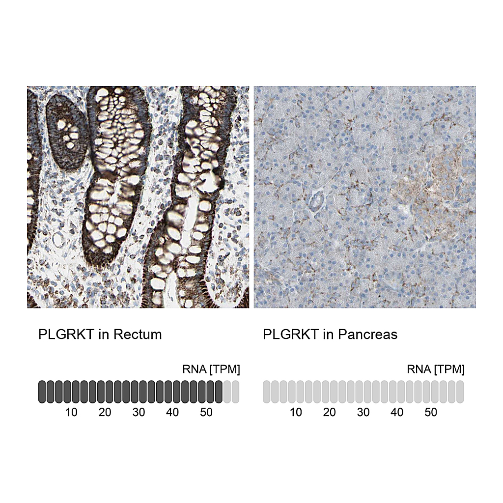 Atlas Antibodies Anti-PLGRKT Antibody