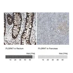 Atlas Antibodies Anti-PLGRKT Antibody