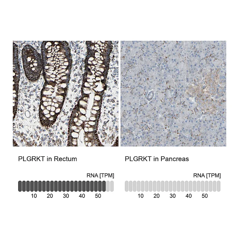 Atlas Antibodies Anti-PLGRKT Antibody