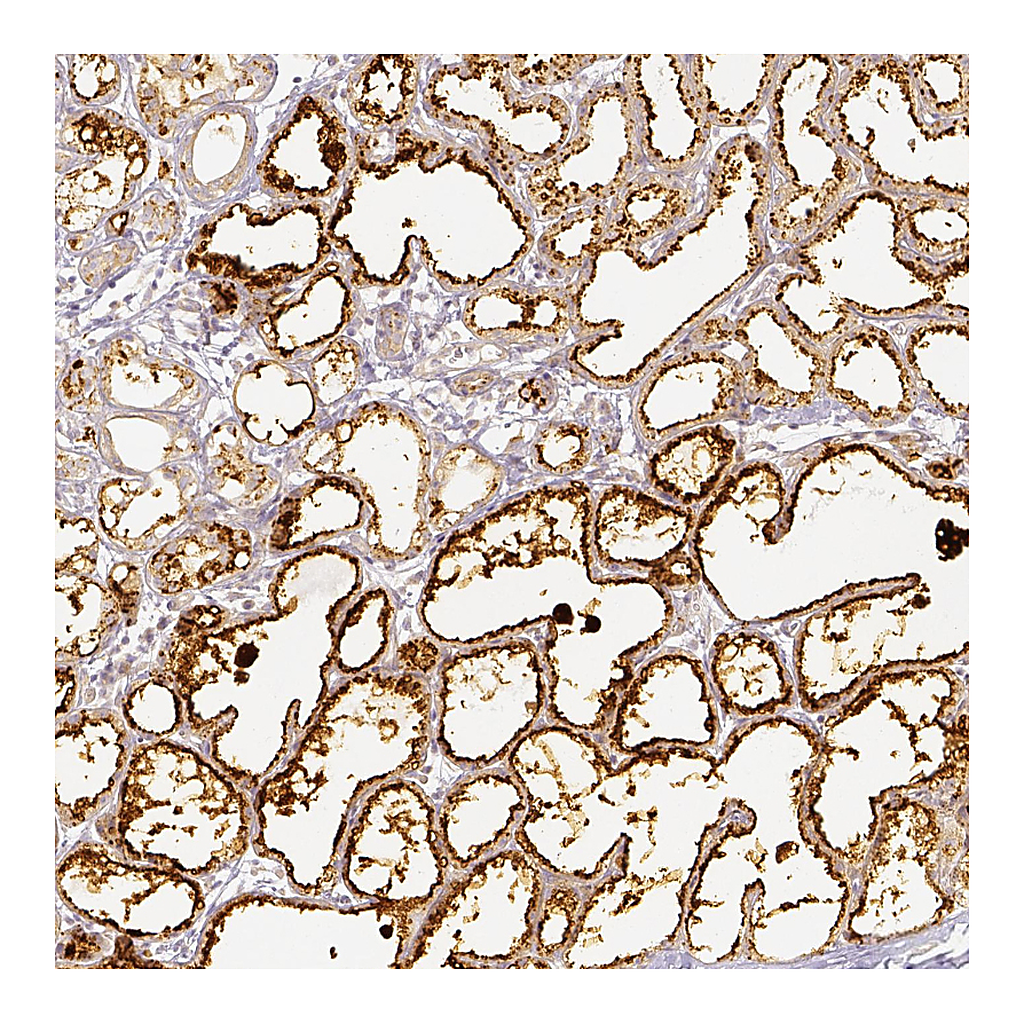 Atlas Antibodies Anti-PLIN2 Antibody