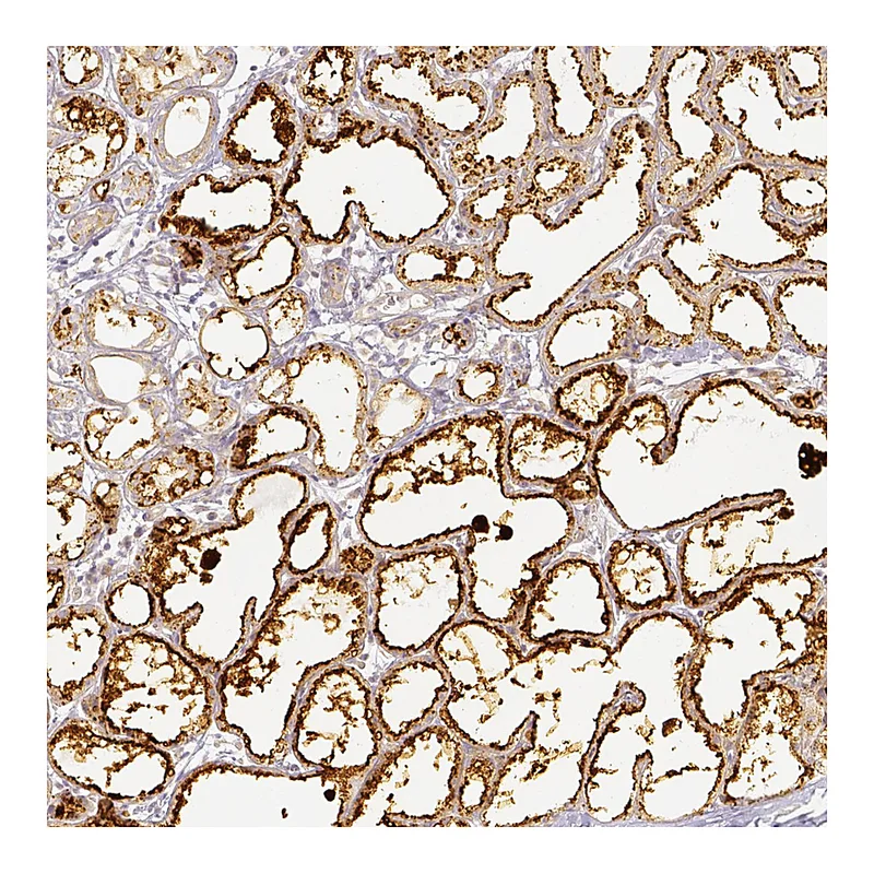 Atlas Antibodies Anti-PLIN2 Antibody