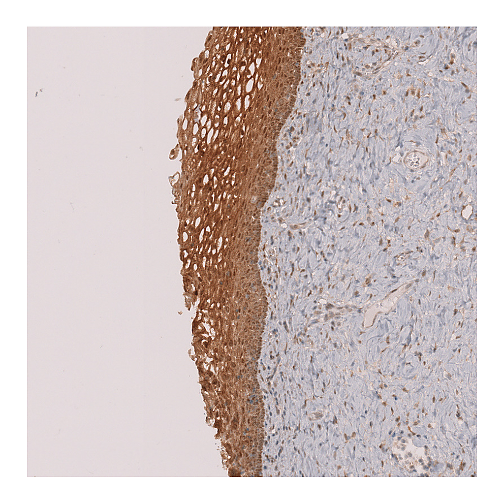 Atlas Antibodies Anti-PLIN3 Antibody