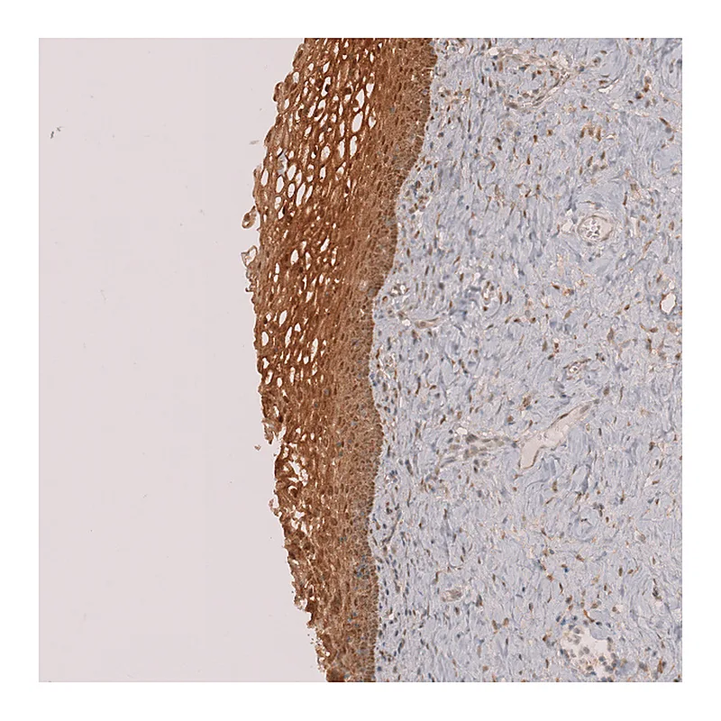 Atlas Antibodies Anti-PLIN3 Antibody