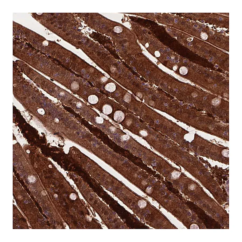 Atlas Antibodies Anti-PLIN3 Antibody