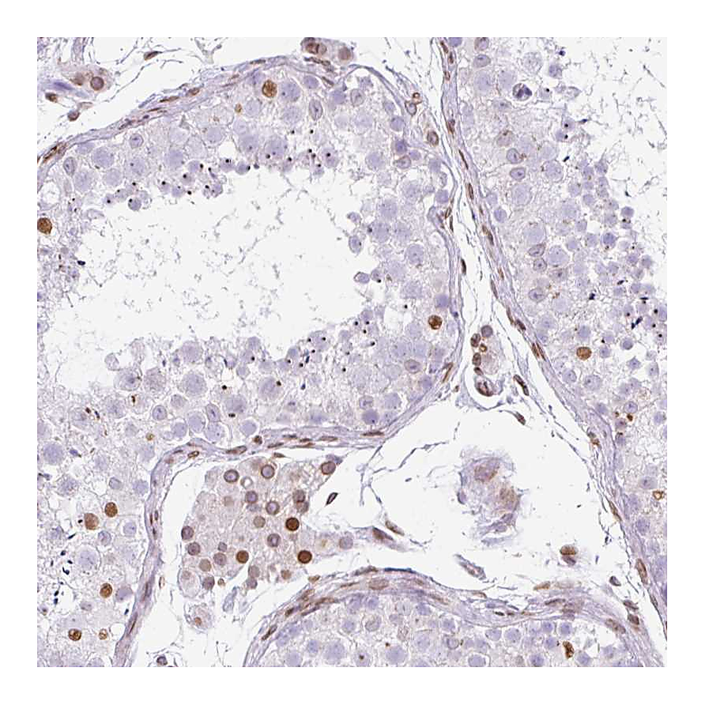 Atlas Antibodies Anti-PLK1 Antibody