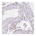 Atlas Antibodies Anti-PLK1 Antibody
