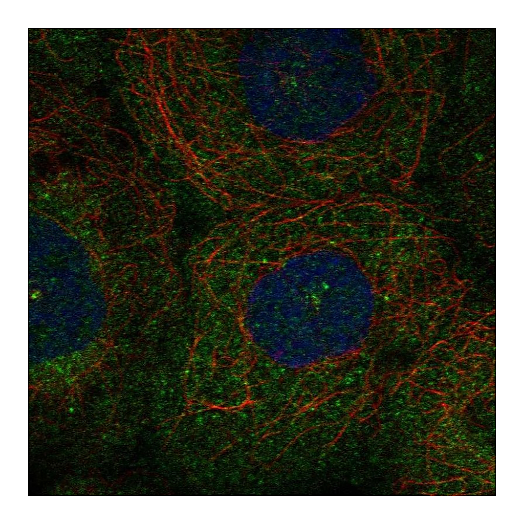Atlas Antibodies Anti-PLK4 Antibody