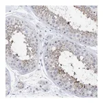 Atlas Antibodies Anti-PLK4 Antibody