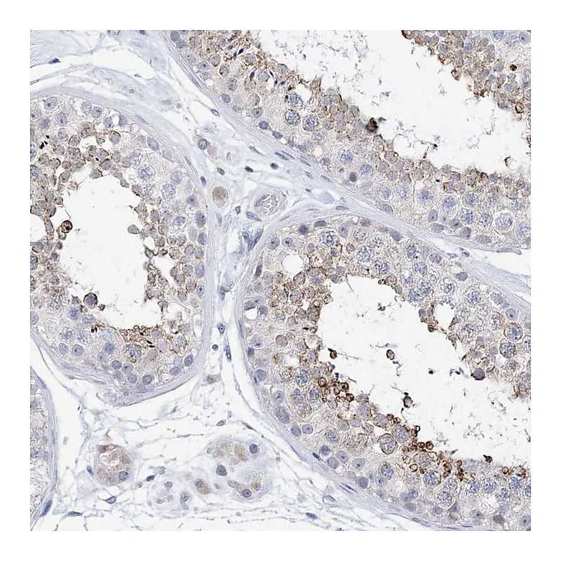Atlas Antibodies Anti-PLK4 Antibody