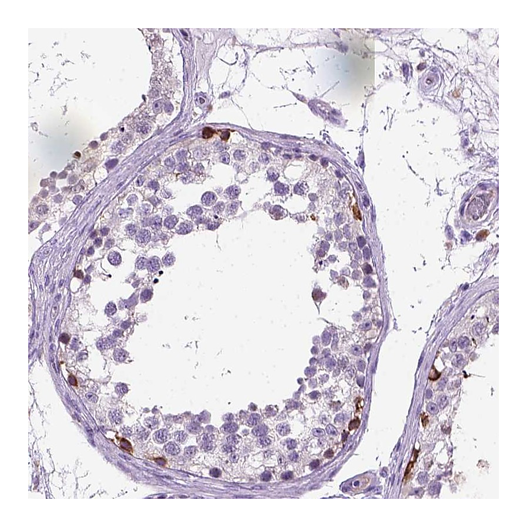 Atlas Antibodies Anti-PLK4 Antibody