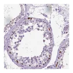 Atlas Antibodies Anti-PLK4 Antibody