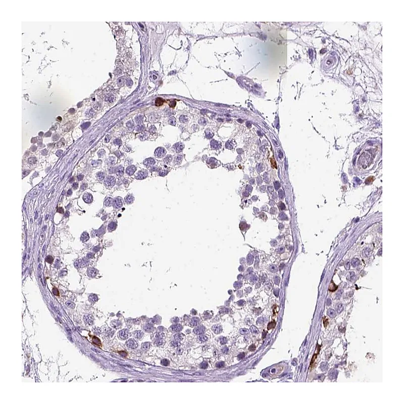Atlas Antibodies Anti-PLK4 Antibody