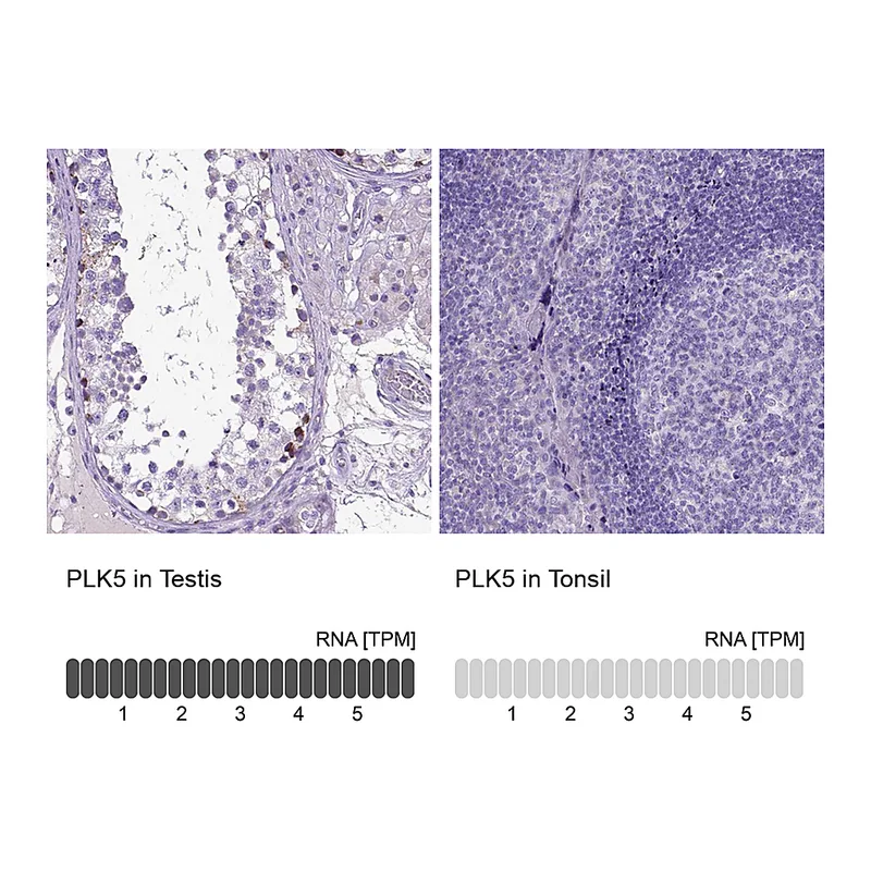 Atlas Antibodies Anti-PLK5 Antibody