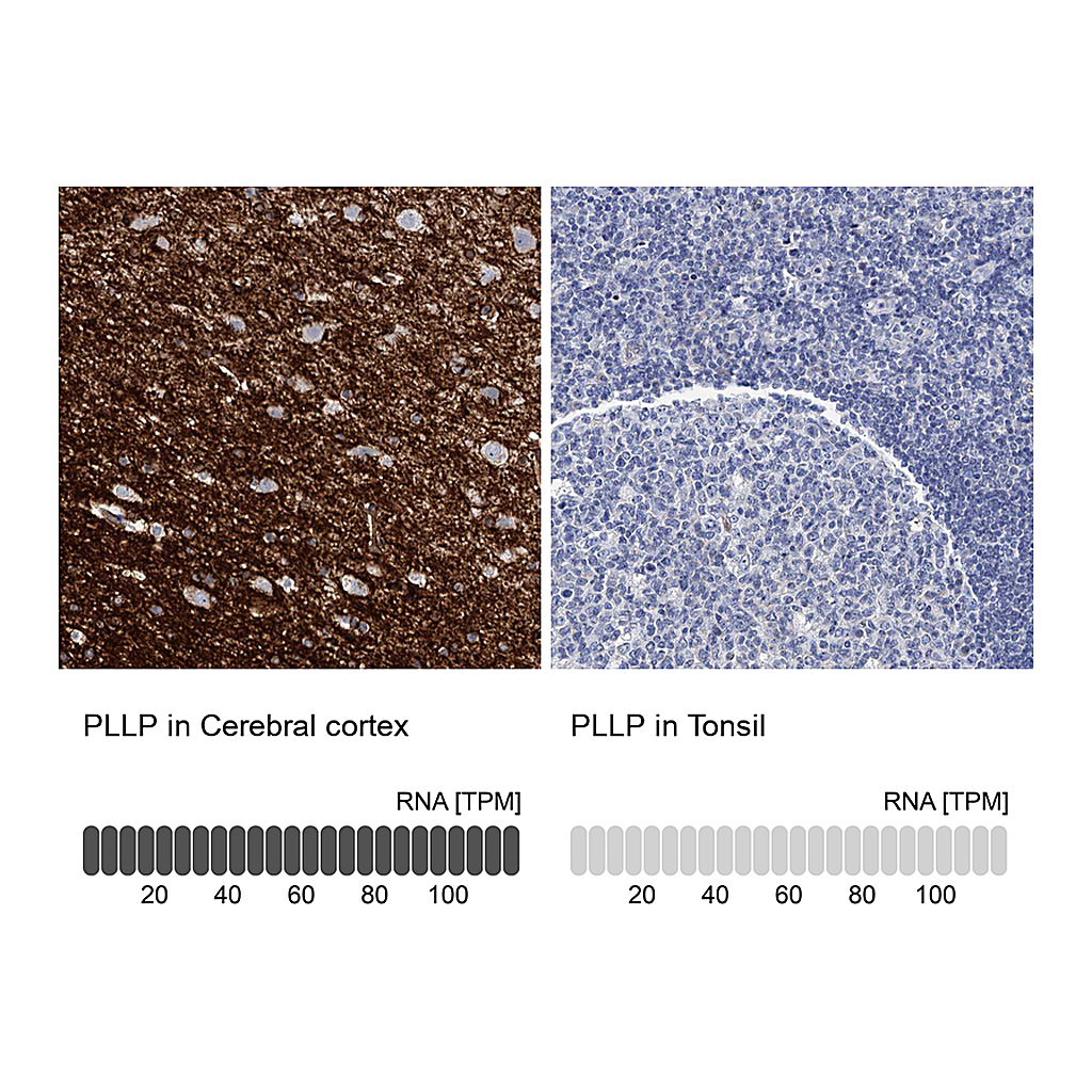 Atlas Antibodies Anti-PLLP Antibody