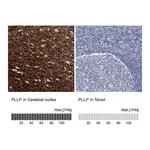 Atlas Antibodies Anti-PLLP Antibody