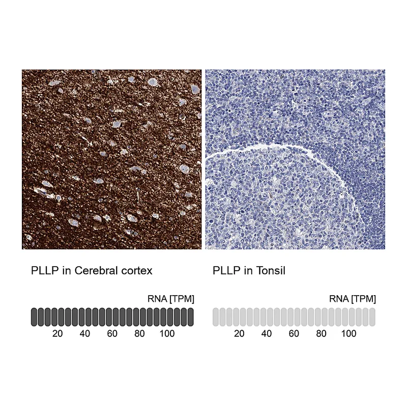 Atlas Antibodies Anti-PLLP Antibody
