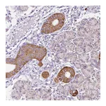 Atlas Antibodies Anti-PLPP2 Antibody