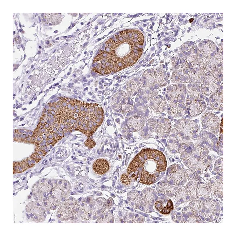 Atlas Antibodies Anti-PLPP2 Antibody
