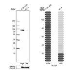 Atlas Antibodies Anti-PLOD1 Antibody