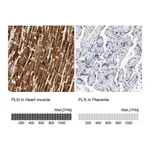 Atlas Antibodies Anti-PLN Antibody