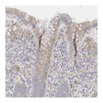 Atlas Antibodies Anti-PLOD3 Antibody