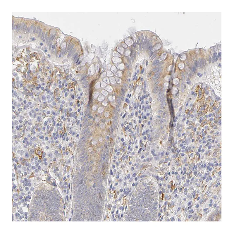 Atlas Antibodies Anti-PLOD3 Antibody
