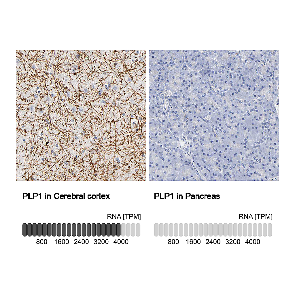 Atlas Antibodies Anti-PLP1 Antibody