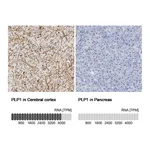 Atlas Antibodies Anti-PLP1 Antibody