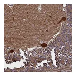 Atlas Antibodies Anti-PLP2 Antibody