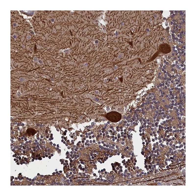 Atlas Antibodies Anti-PLP2 Antibody