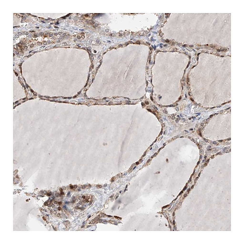 Atlas Antibodies Anti-PLPP3 Antibody