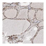Atlas Antibodies Anti-PLPP3 Antibody