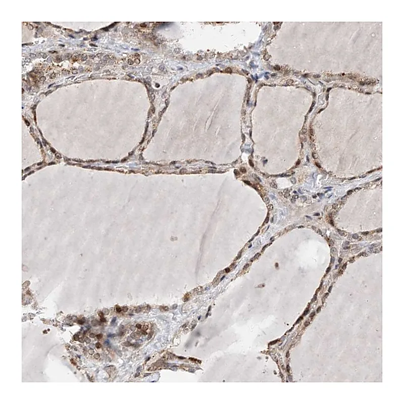 Atlas Antibodies Anti-PLPP3 Antibody
