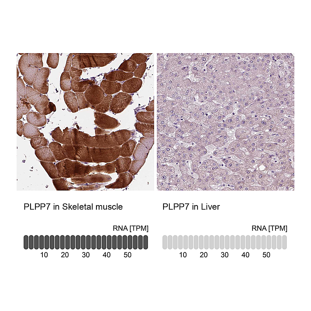 Atlas Antibodies Anti-PLPP7 Antibody