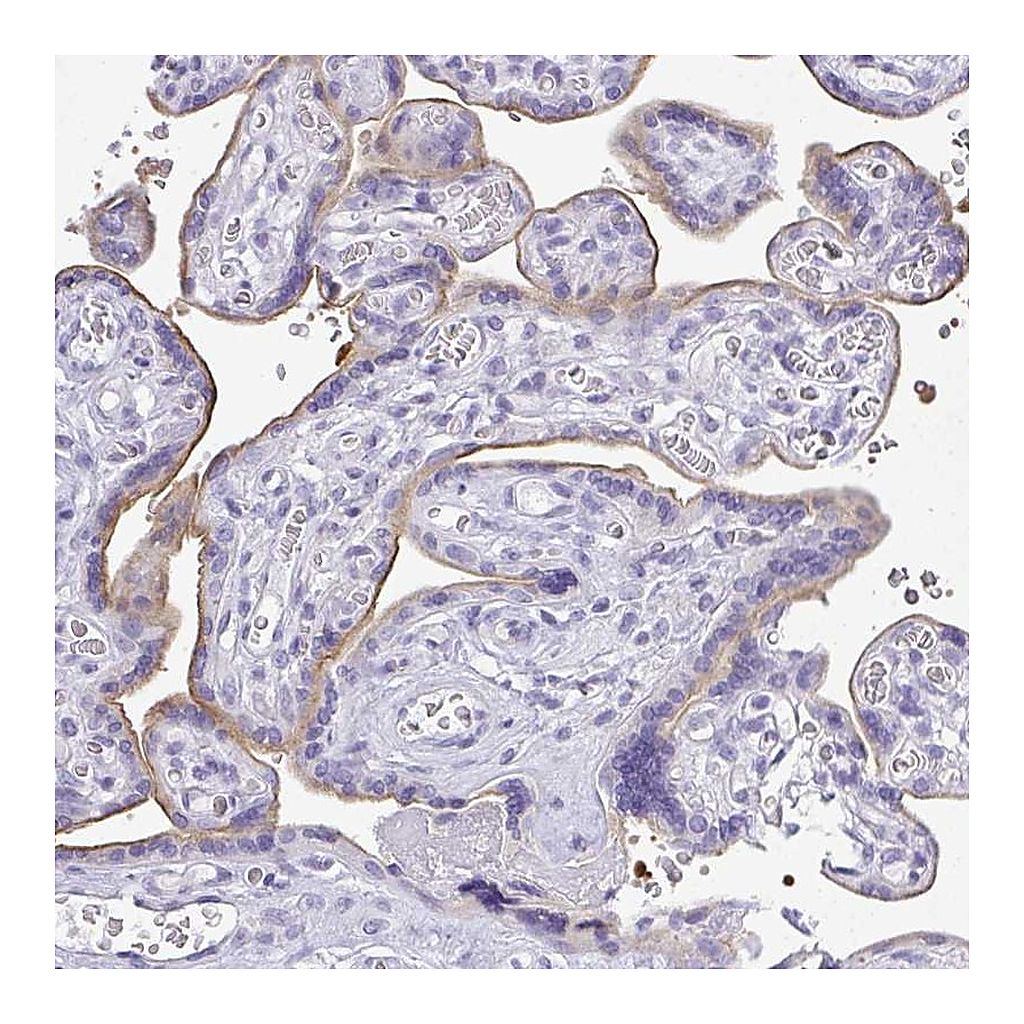 Atlas Antibodies Anti-PLPPR3 Antibody
