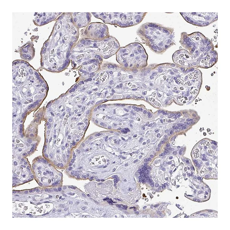 Atlas Antibodies Anti-PLPPR3 Antibody