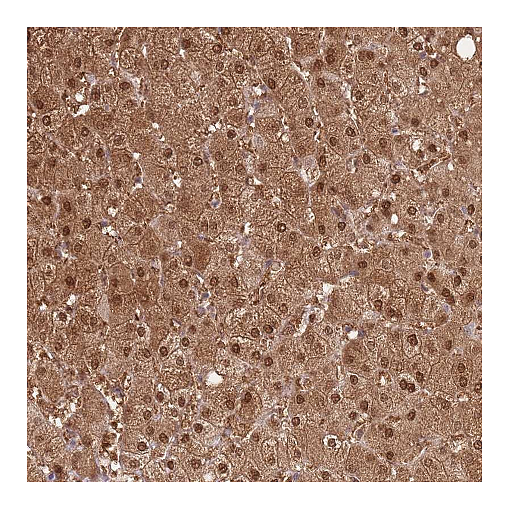 Atlas Antibodies Anti-PLPPR2 Antibody