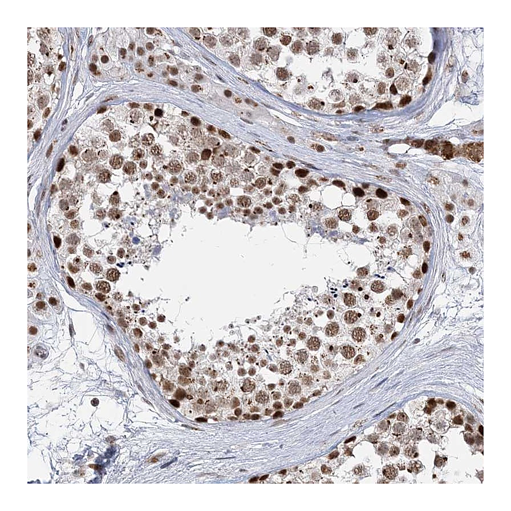 Atlas Antibodies Anti-PLRG1 Antibody