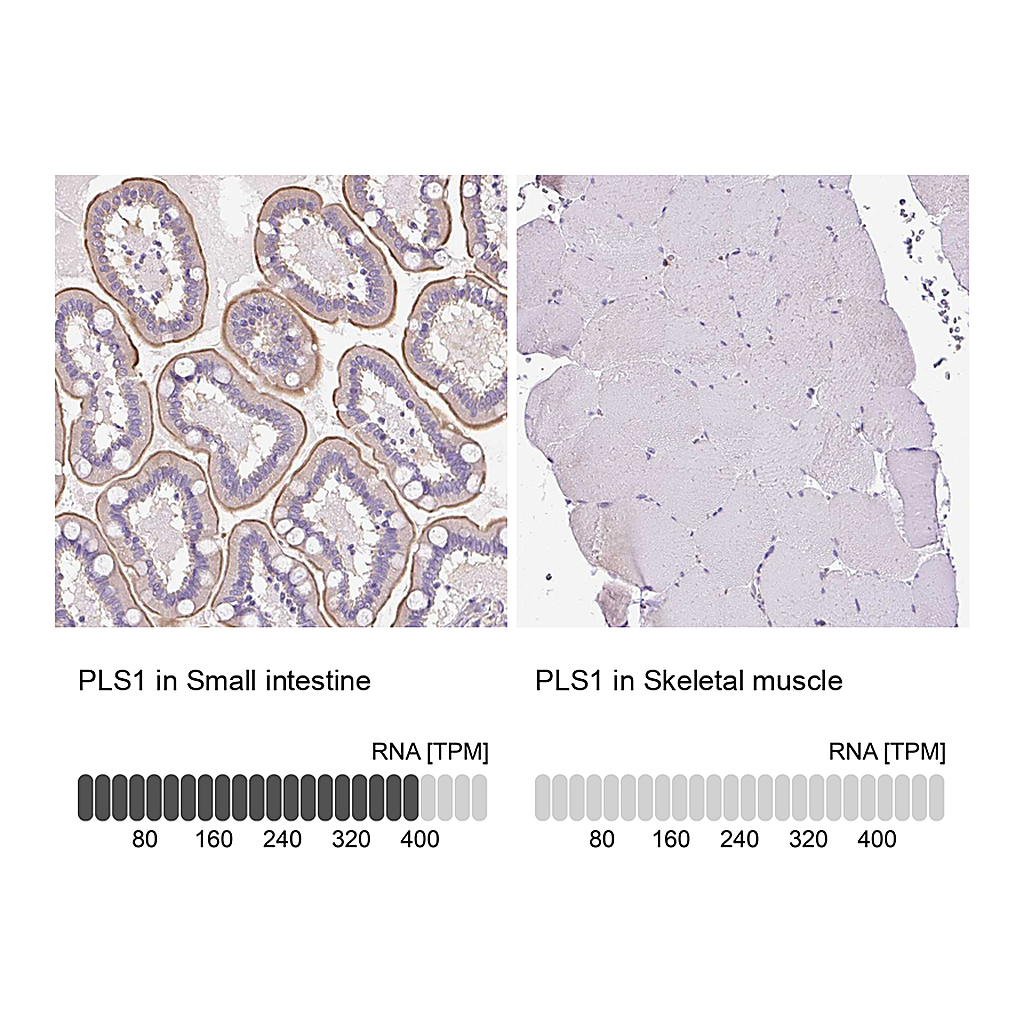 Atlas Antibodies Anti-PLS1 Antibody