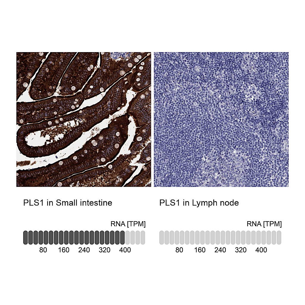 Atlas Antibodies Anti-PLS1 Antibody