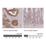 Atlas Antibodies Anti-PLS3 Antibody