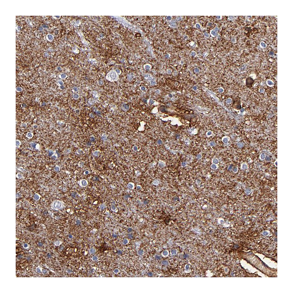 Atlas Antibodies Anti-PLSCR4 Antibody