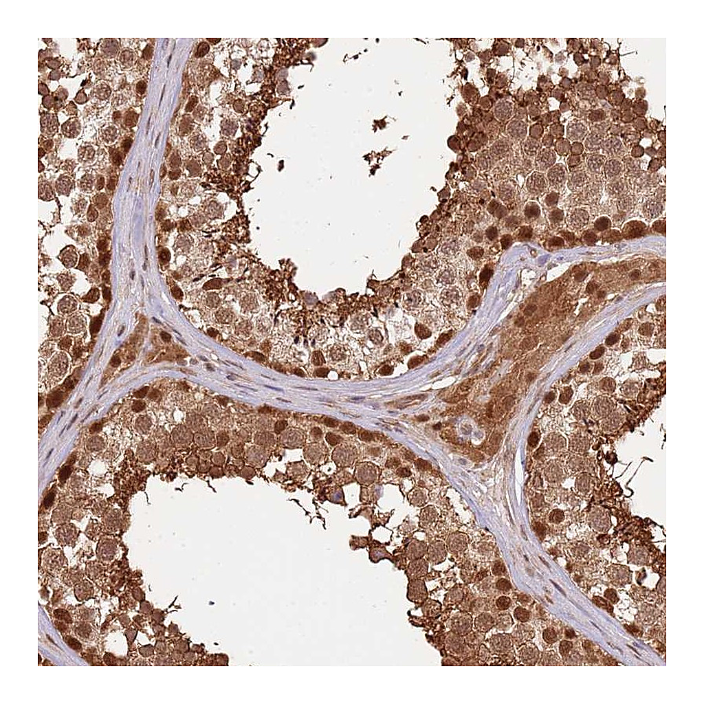 Atlas Antibodies Anti-PLSCR5 Antibody