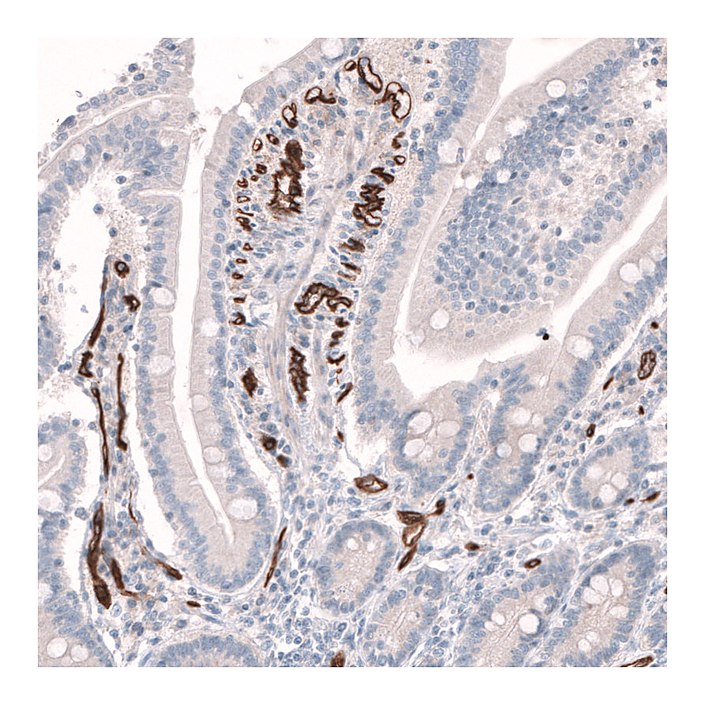 Atlas Antibodies Anti-PLVAP Antibody