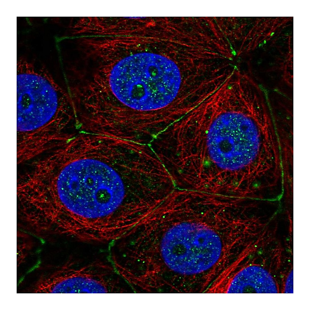 Atlas Antibodies Anti-PLXNA3 Antibody