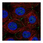 Atlas Antibodies Anti-PLXNA3 Antibody