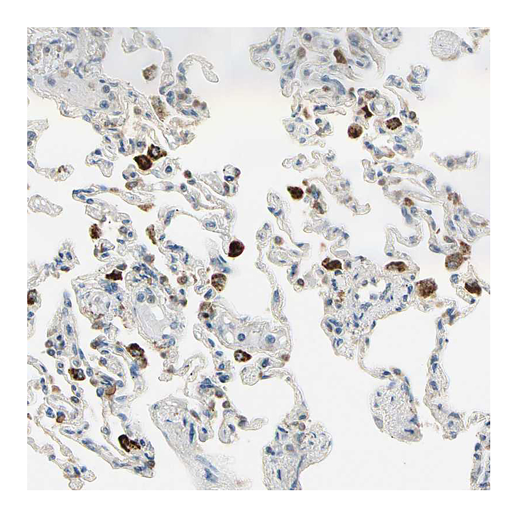 Atlas Antibodies Anti-PLXNA1 Antibody